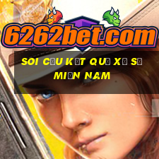 soi cầu kết quả xổ số miền nam